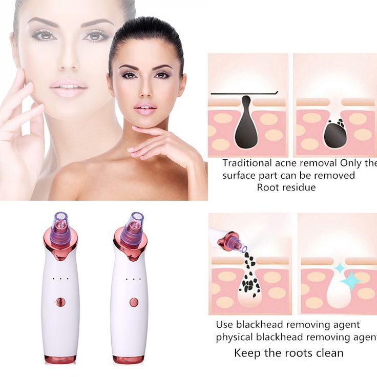 BLACK AND WHITE HEADS SUCTION MACHINE