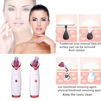 BLACK AND WHITE HEADS SUCTION MACHINE