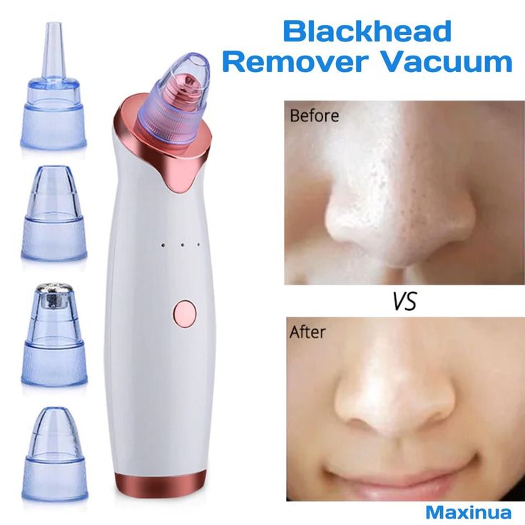 BLACK AND WHITE HEADS SUCTION MACHINE