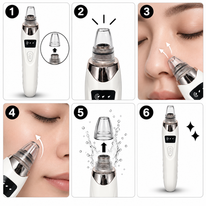 GLAMOUR CLASSIC BLACKHEADS REMOVER MACHINE
