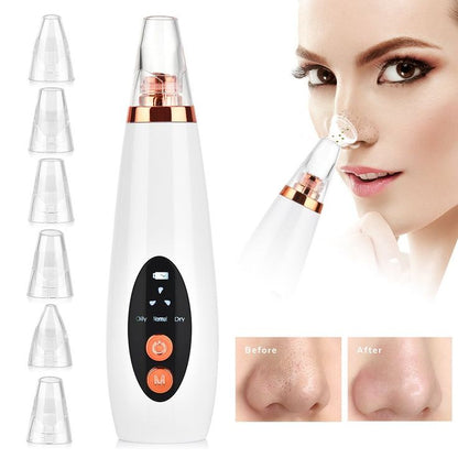 BLACK HEADS REMOVEL MACHINE 6-IN-1