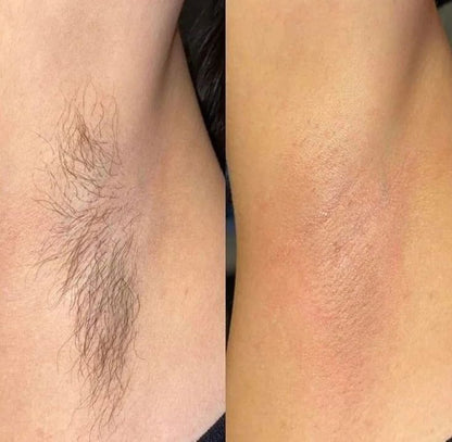 LADIES EPILATOR  KM-189 PAIN LESS HAIR REMOVER