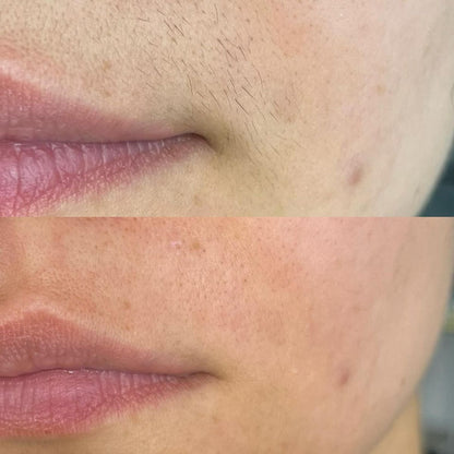 FLAWLESS HAIR REMOVER | REMOVER THE HAIR WITH OUT ANY PAIN