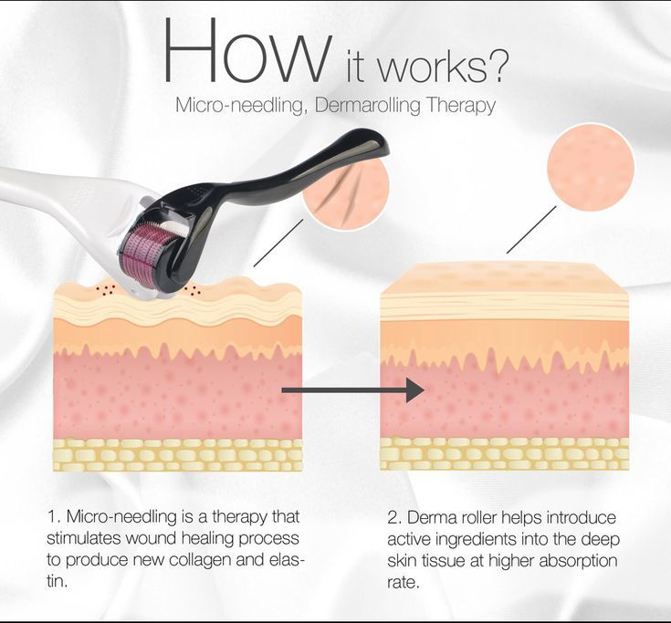 DERMA ROLLER FOR HAIR
