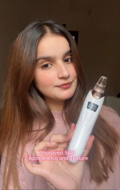 BLACK HEADS ACNE OIL REMOVER 5 in 1